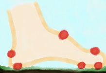 Skizze: Fuß mit Blasen