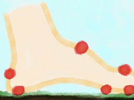 Skizze: Fuß mit Blasen